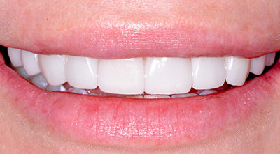 Dental treatment After