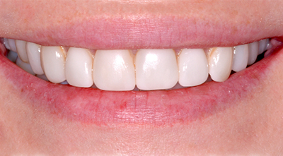 Dental treatment Before