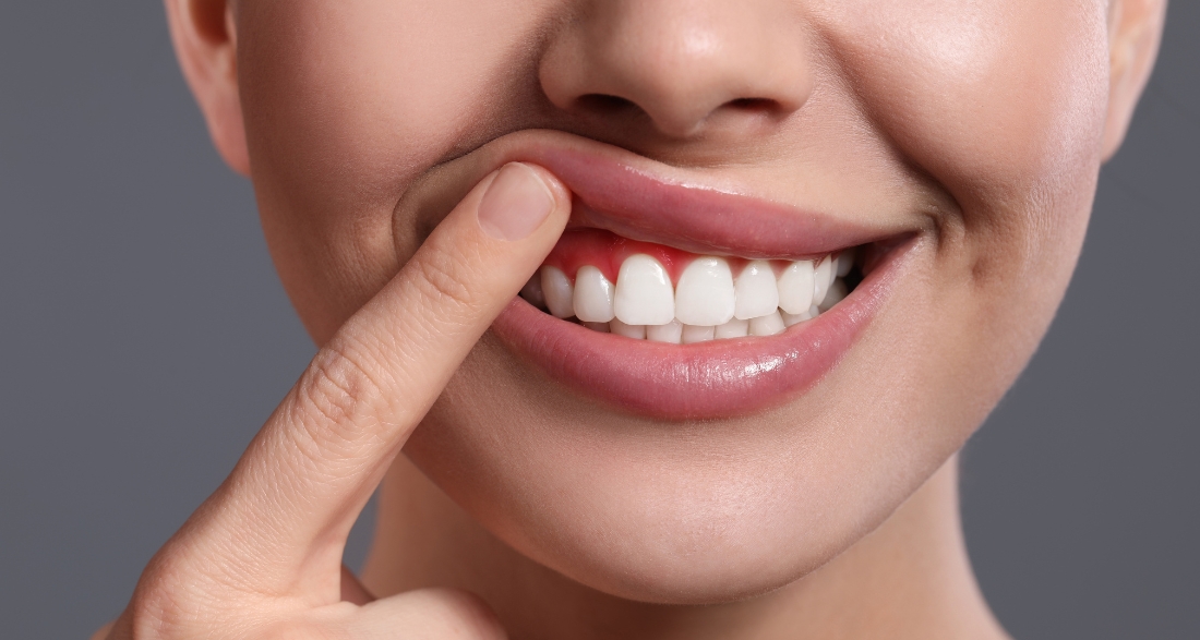 Tips for Healthier Gums In The New Year