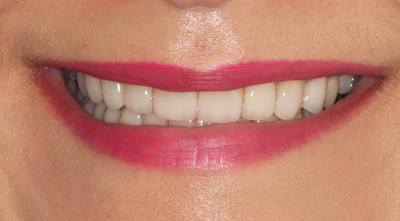 Dental treatment After