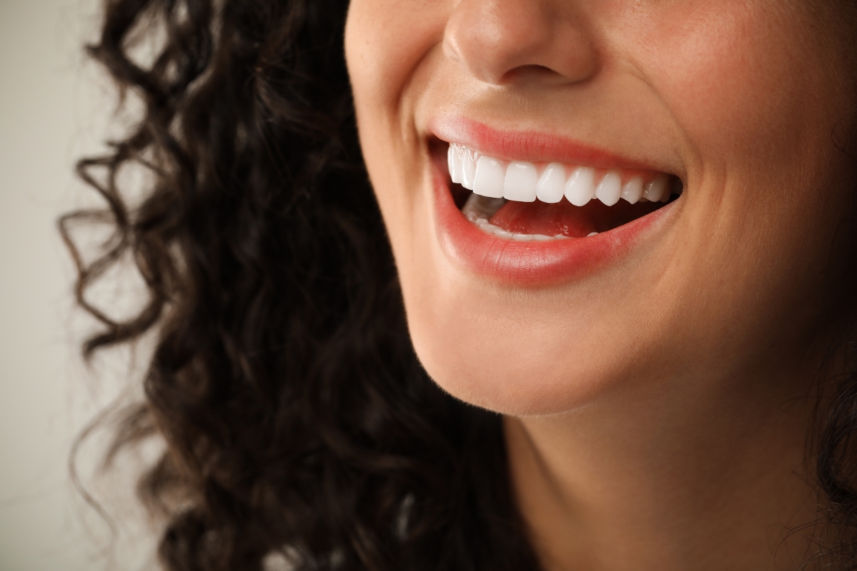 veneers-in-Jamaica-Plain